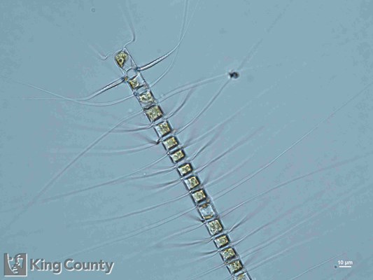 Photo of Chaetoceros crucifer